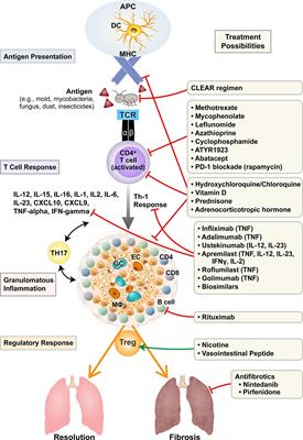 Treatment of Sarcoidosis: A Multidisciplinary Approach